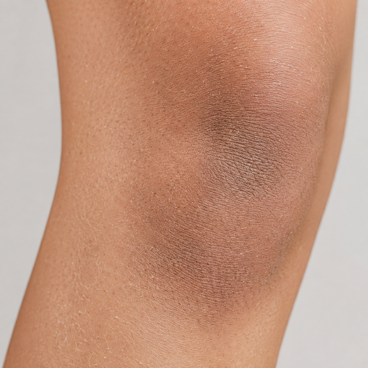 Close-up of dull and dry-looking knee skin